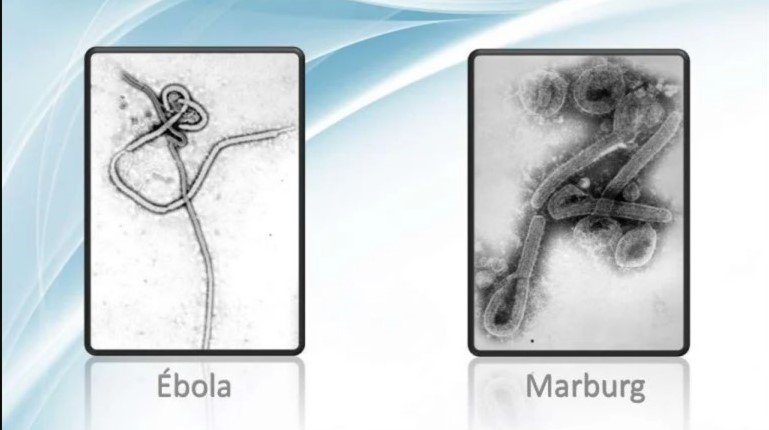 Marburg and Ebola Electron Microscopy