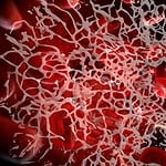 Blood Clots Contaminated Blood Covid Trust