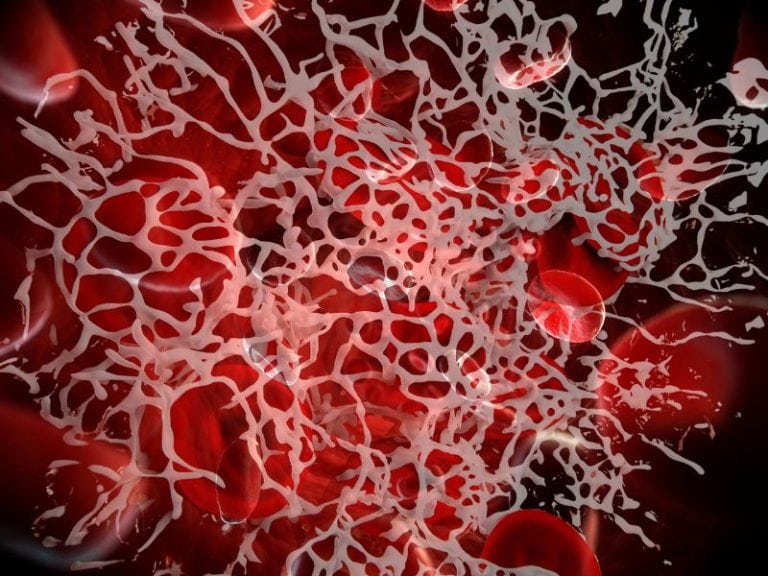 Blood Clots Contaminated Blood Covid Trust